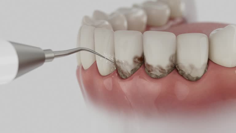 Reliable Root Canal Treatment contractor in Person County County, NC by Dentist Open Now